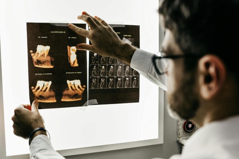 Dentist analyzing dental x-rays to assess patient teeth health in a clinical setting.